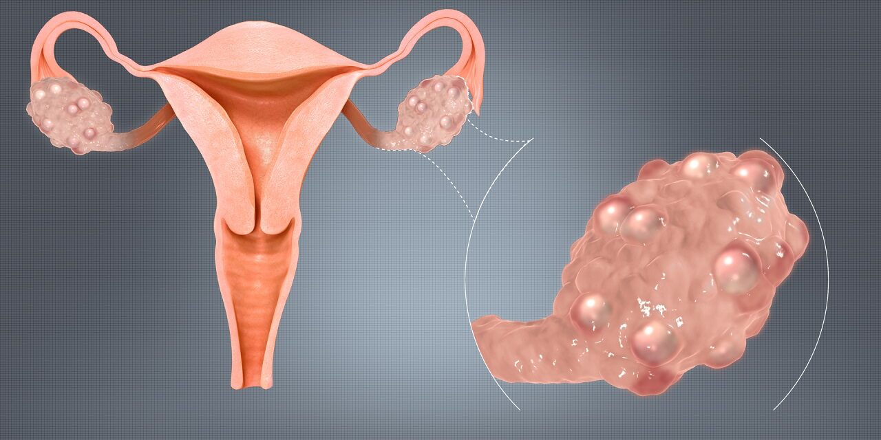 menopause fatigue
